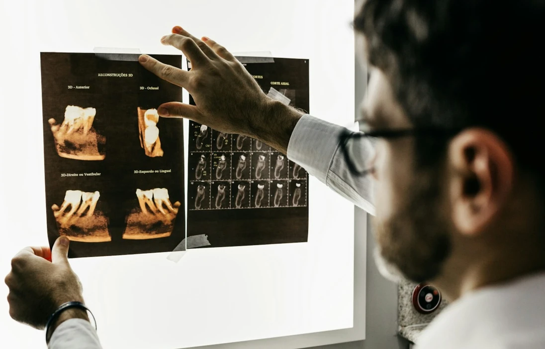Leczenie endodontyczne – specjalista ogląda zdjęcia RTG zębów