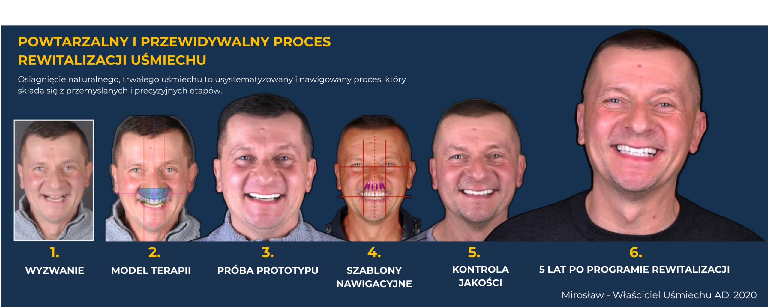 Odzyskaj Piękny Uśmiech z Natural Smile Journey™ w Luboniu 36 endoestetica baner historia Miroslawa scaled