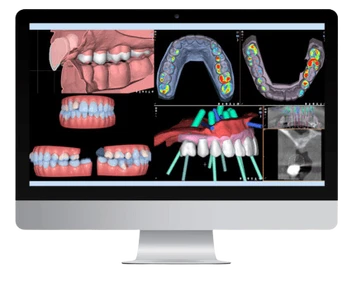 Odzyskaj Piękny Uśmiech z Natural Smile Journey™ w Luboniu 29 endoestetica cad badanie