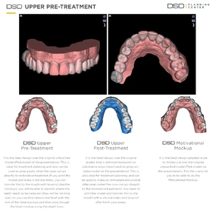 Odzyskaj Piękny Uśmiech z Natural Smile Journey™ w Luboniu 30 endoestetica dsd upper pre treatment