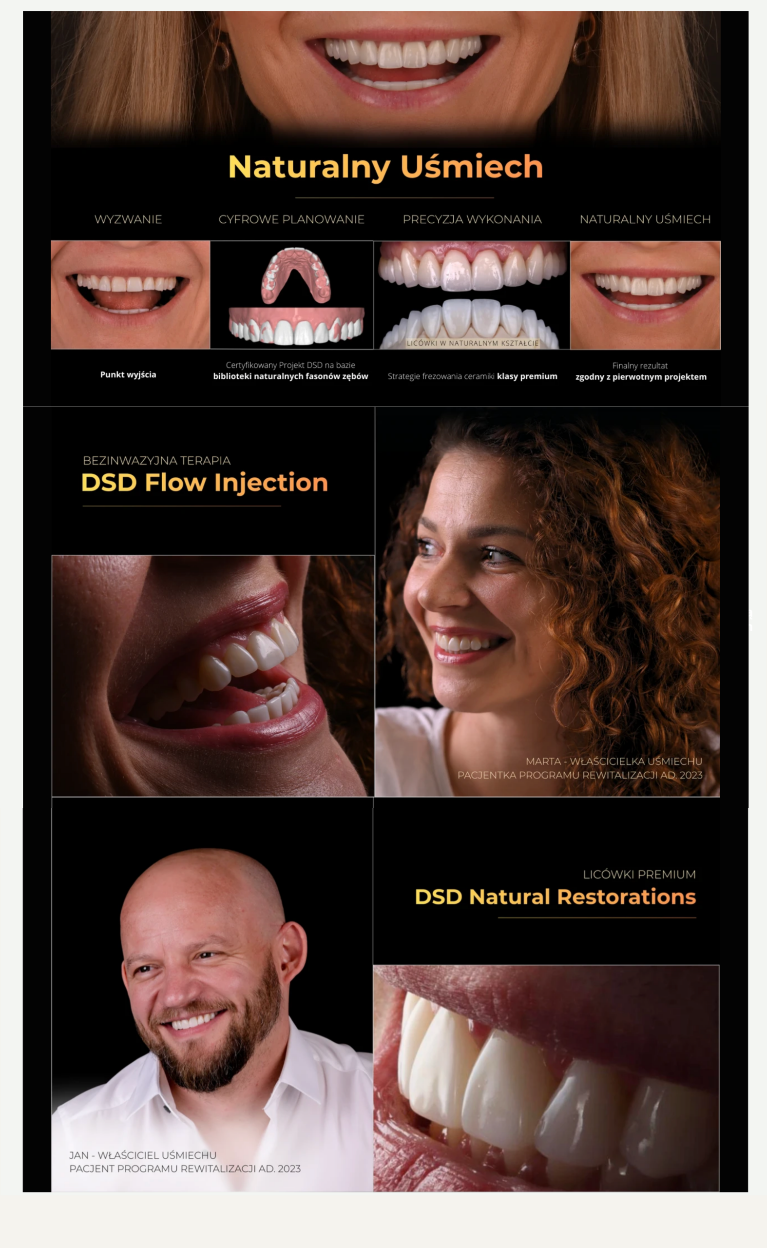 Licówki DSD w Luboniu – naturalny i piękny uśmiech na nowo 5 endoestetica plakat naturalny usmiech dsd scaled