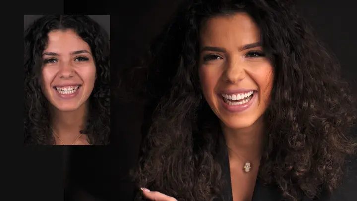 Licówki DSD w Luboniu – naturalny i piękny uśmiech na nowo 10 Sara