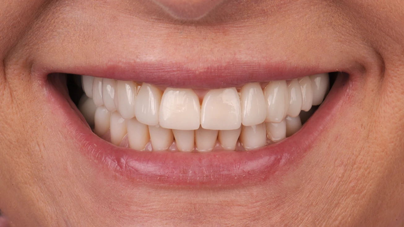 Jak zacząć leczenie stomatologiczne w EndoEstetica Luboń? 4 Po remoncie