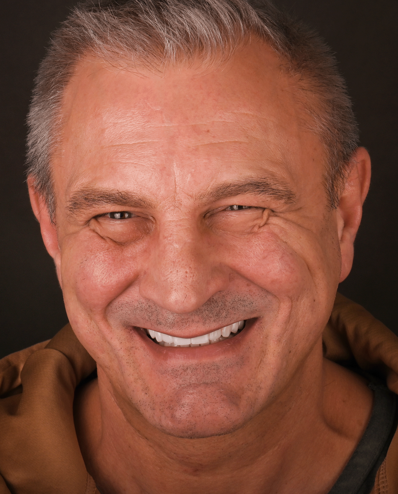 Chcesz mieć zęby, z których jesteś dumny? 12 Właściciel uśmiechu 5