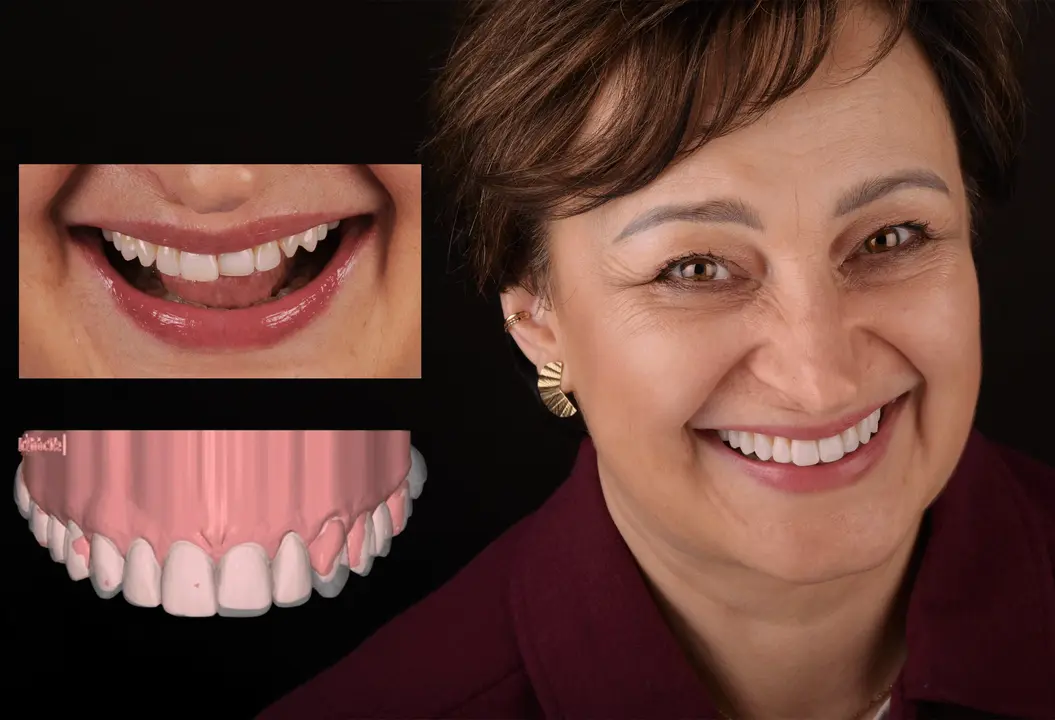 Zestawienie efektów leczenia – Pani Lucyna