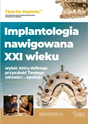 Odzyskaj uśmiech – Protokół Time For Implants™ 44 Time For Implants – Informator