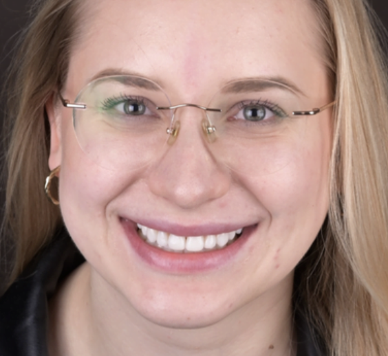 Program rewitalizacji uśmiechu w Luboniu – sprawdź ofertę EndoEstetica 6 Lekka Stomatologia 3