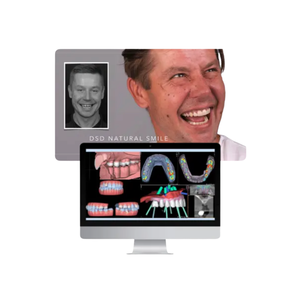 Program rewitalizacji uśmiechu w Luboniu – sprawdź ofertę EndoEstetica 3 DSD Natural Smile