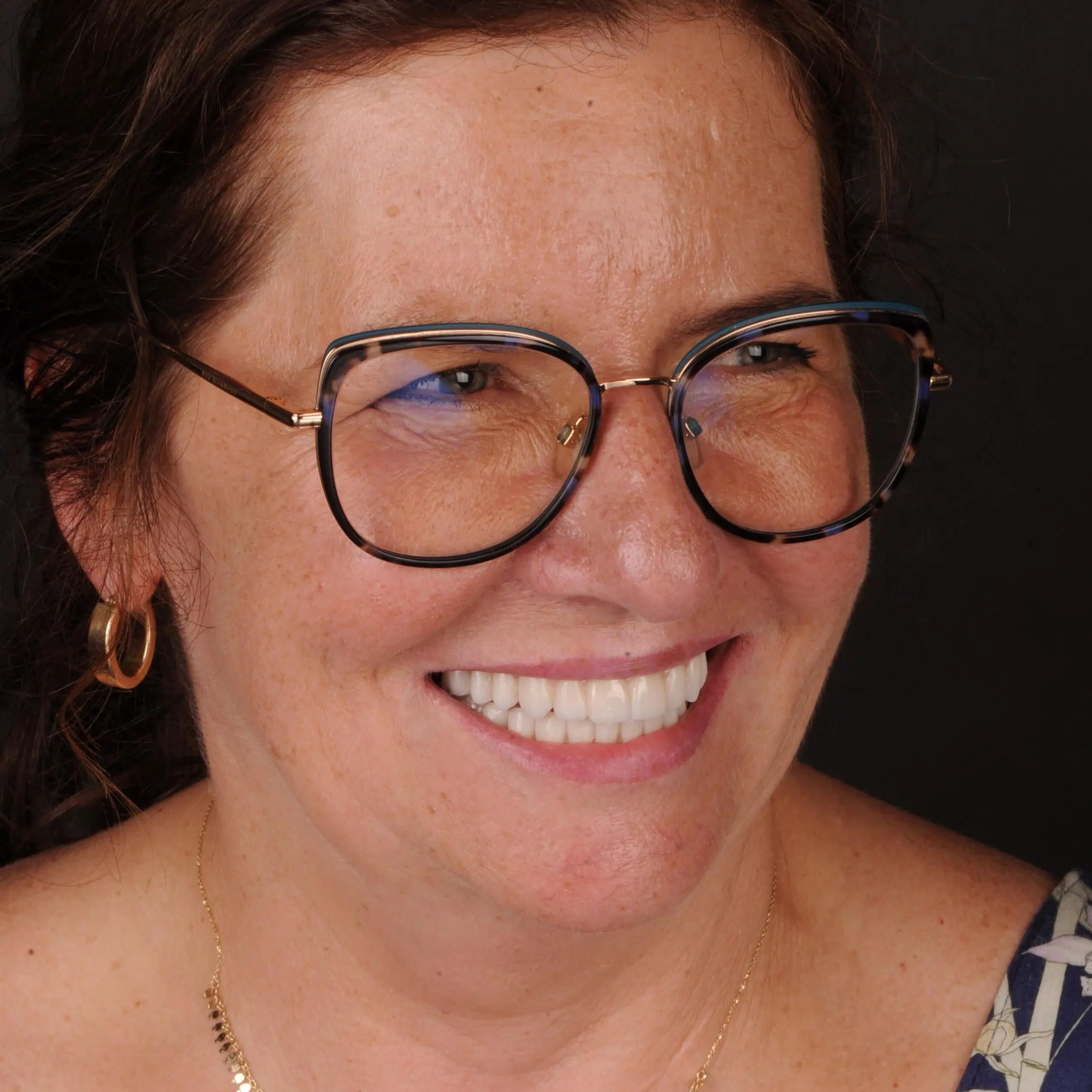 Odzyskaj uśmiech – Protokół Time For Implants™ 37 Efekt 1