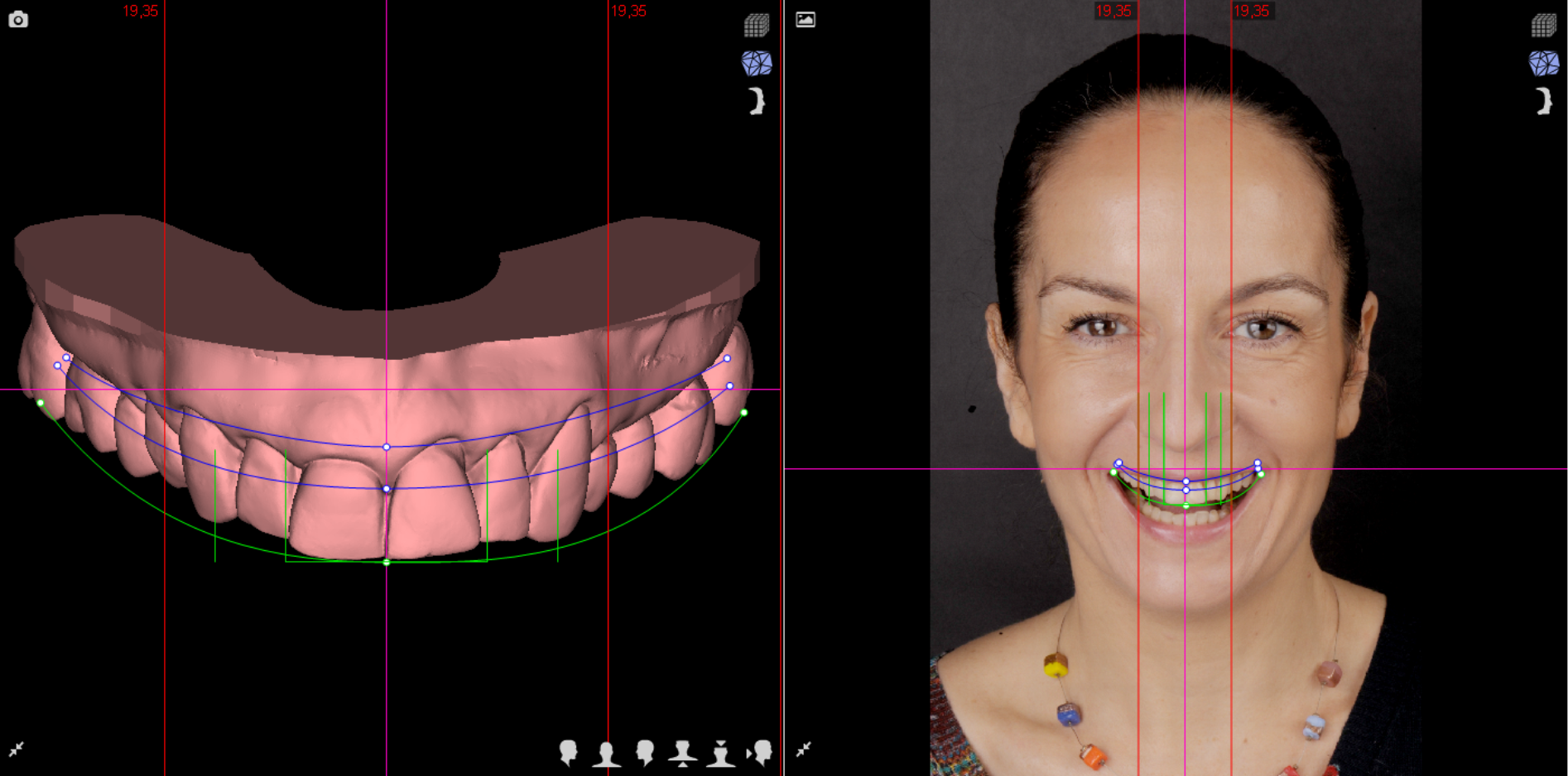 Pani Agata – faza modelowania terapii 1