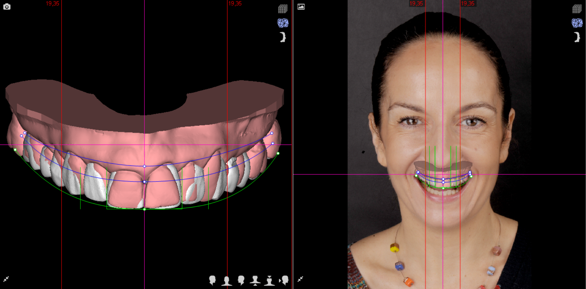 Pani Agata – faza modelowania terapii 2