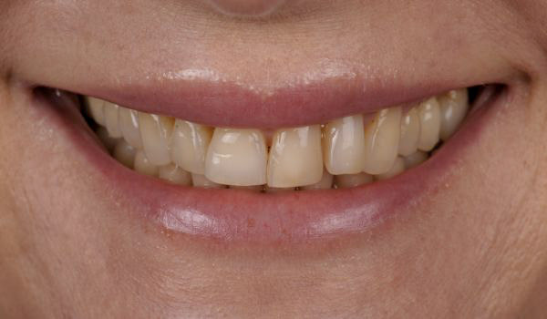 Pani Agata – przed terapią