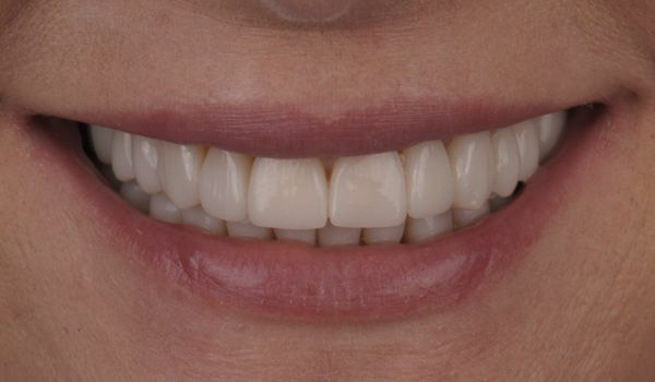 Pani Agata – po terapii