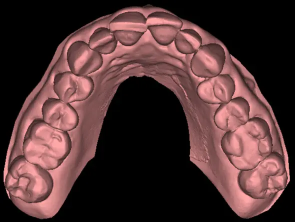 Skan 3D uzębienia pani Agaty – widok górny
