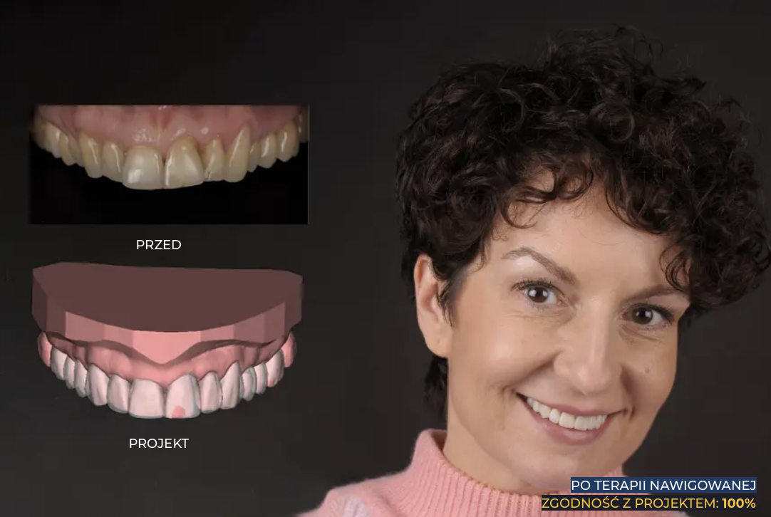 Pani Agata – po terapii nawigowanej