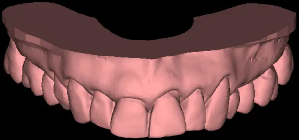 Skan 3D uzębienia pani Agaty – widok przedni