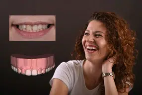 Metamorfoza uśmiechu pani Marty dzięki Invisalign i odbudowie zębów 8 Pacjentka 5