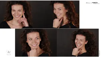 Metamorfoza uśmiechu pani Marty dzięki Invisalign i odbudowie zębów 7 Pacjentka 4