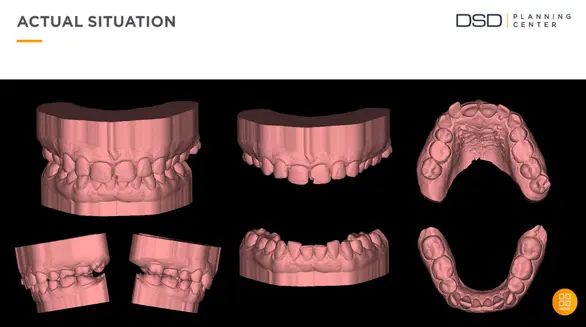 Pani Marta – skan 3D przed leczeniem