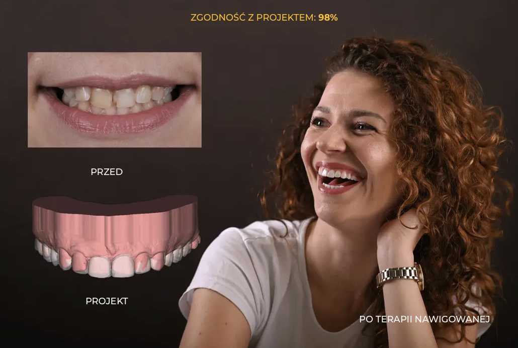 Efekty terapii nawigowanej – Pani Marta