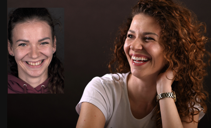 Opinie Pacjentów EndoEstetica Clinic – Metamorfozy Uśmiechu Przed i Po 20 Historia Pani Marty