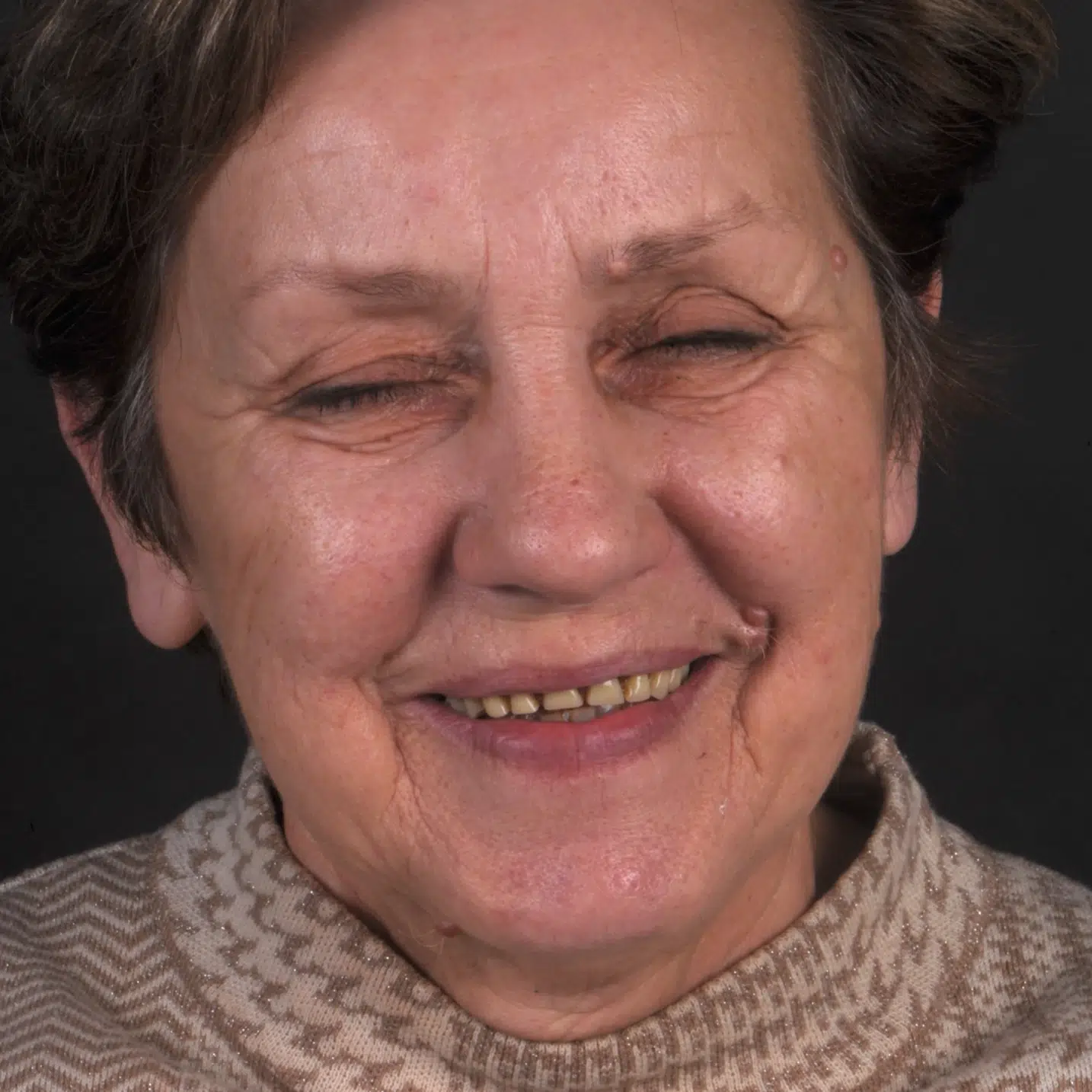 Odzyskaj uśmiech – Protokół Time For Implants™ 41 Wyzwanie 3