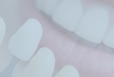 Abonamentowa higienizacja i kontrola zębów w EndoEstetica Clinic Luboń 3 Wybielanie Regeneracyjne